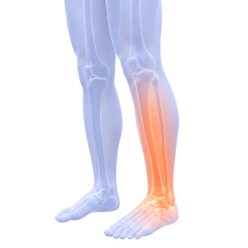 E-BOOK -  Le guide Soveria : Jambes légères en 7 jours